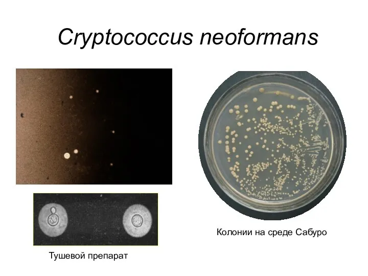 Cryptococcus neoformans Тушевой препарат Колонии на среде Сабуро