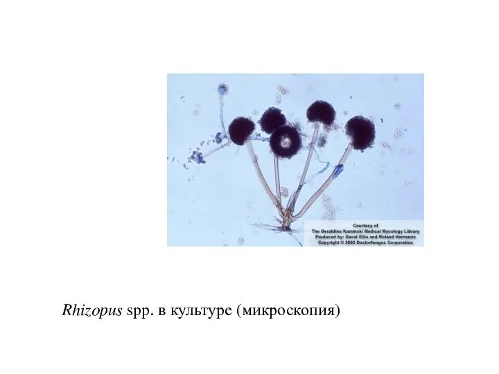 Rhizopus spp. в культуре (микроскопия)