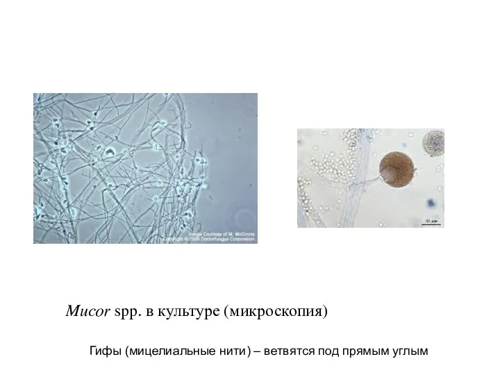 Mucor spp. в культуре (микроскопия)) Гифы (мицелиальные нити) – ветвятся под прямым углым