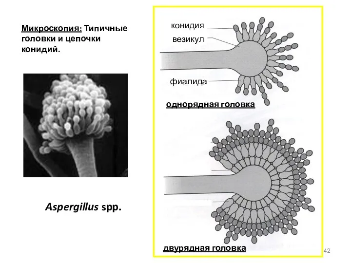 Aspergillus spp. Микроскопия: Типичные головки и цепочки конидий.