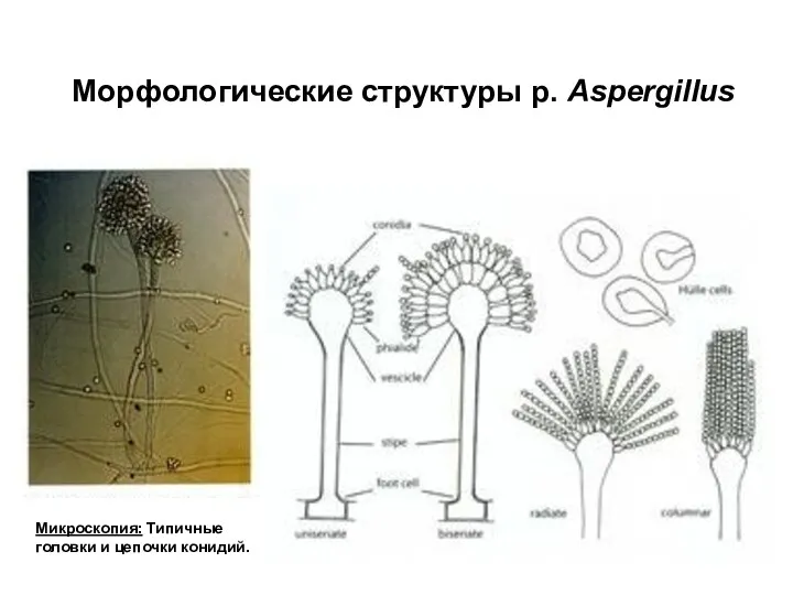 Морфологические структуры p. Aspergillus Микроскопия: Типичные головки и цепочки конидий.