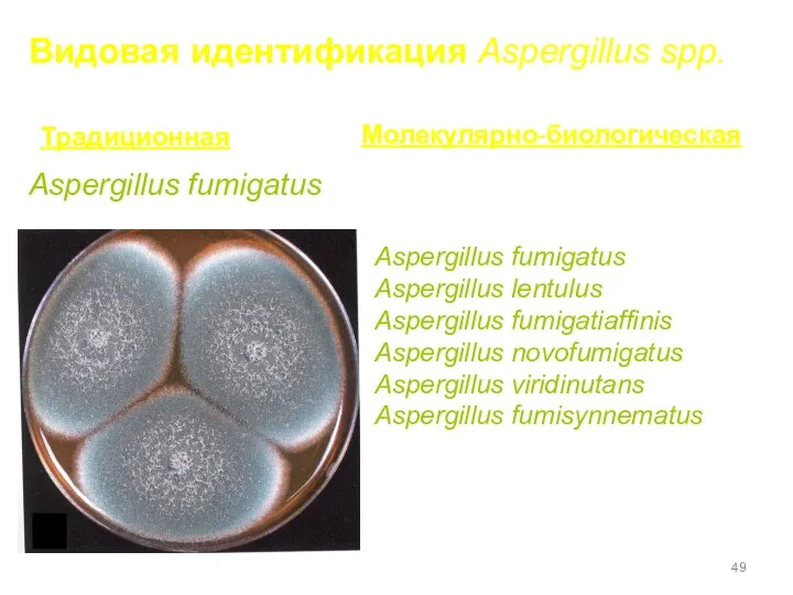 Видовая идентификация Aspergillus spp. Aspergillus fumigatus Aspergillus fumigatus Aspergillus lentulus Aspergillus fumigatiaffinis Aspergillus