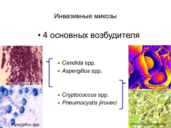 Инвазивные микозы 4 основных возбудителя Candida spp. Aspergillus spp. Cryptococcus spp. Pneumocystis jiroveci