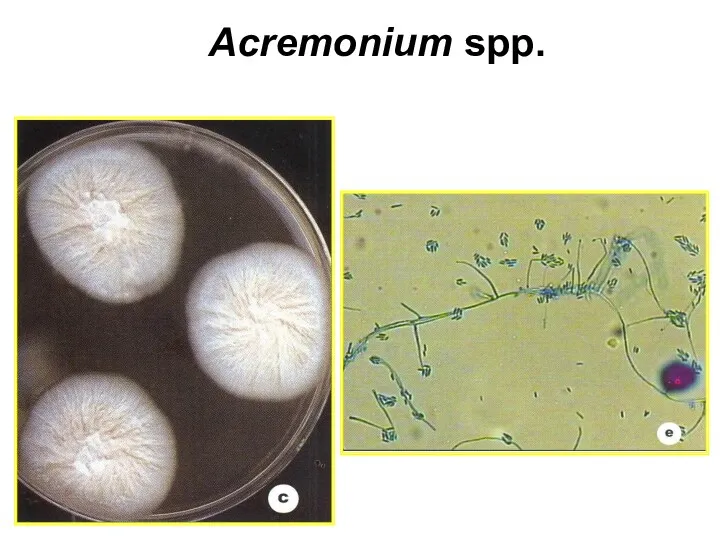 Acremonium spp.