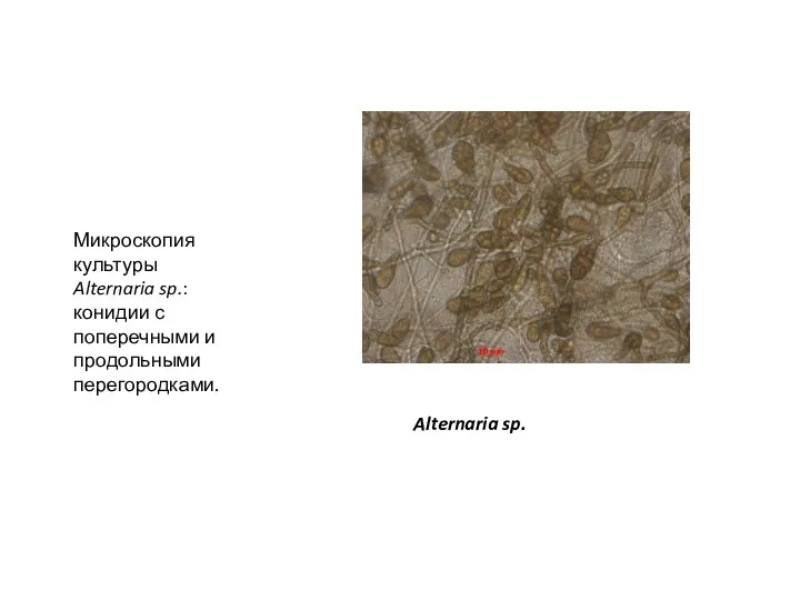 Alternaria sp. Микроскопия культуры Alternaria sp.: конидии с поперечными и продольными перегородками.
