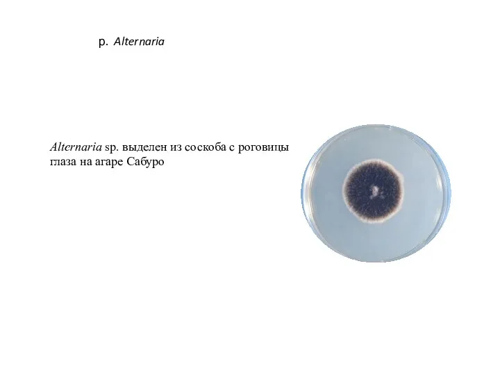 Alternaria sp. выделен из соскоба с роговицы глаза на агаре Сабуро р. Alternaria