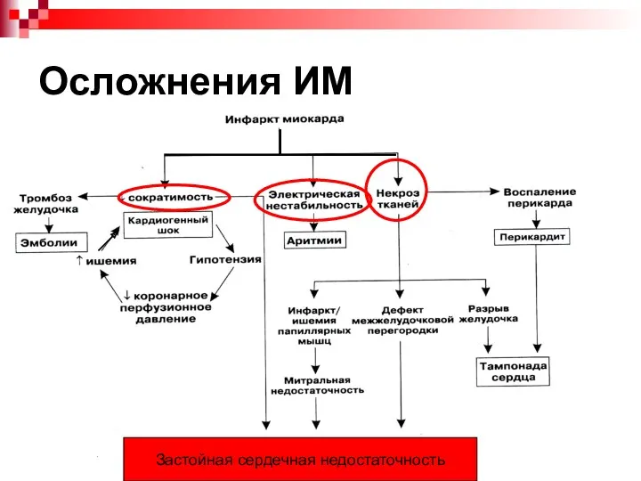 Осложнения ИМ Застойная сердечная недостаточность