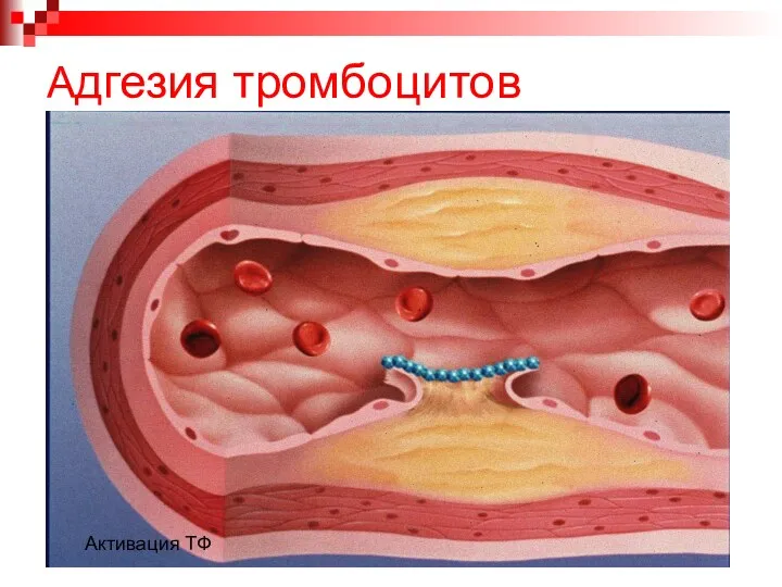 Адгезия тромбоцитов Активация ТФ