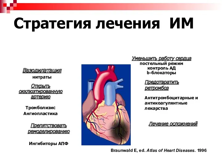 Стратегия лечения ИМ