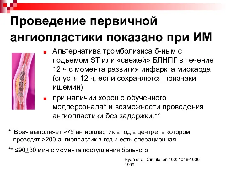 Проведение первичной ангиопластики показано при ИМ Альтернатива тромболизиса б-ным с подъемом ST или