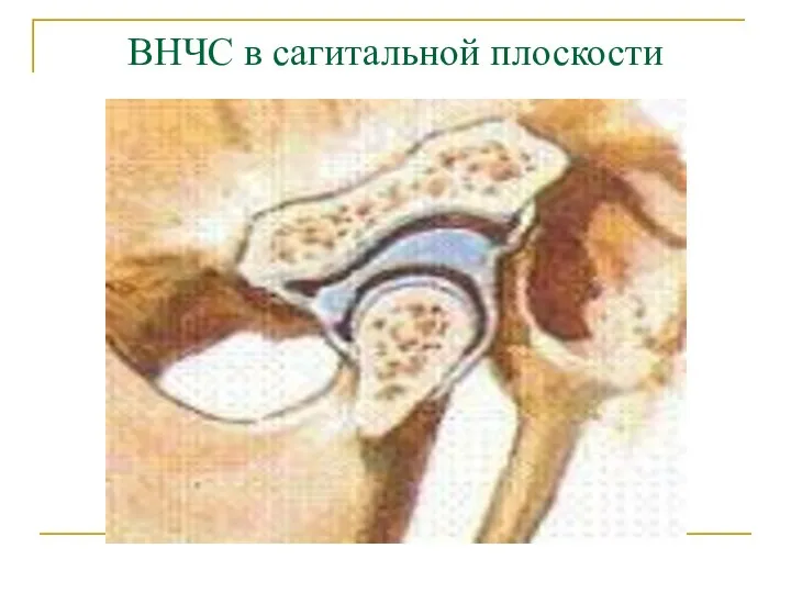 ВНЧС в сагитальной плоскости