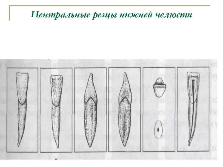 Центральные резцы нижней челюсти