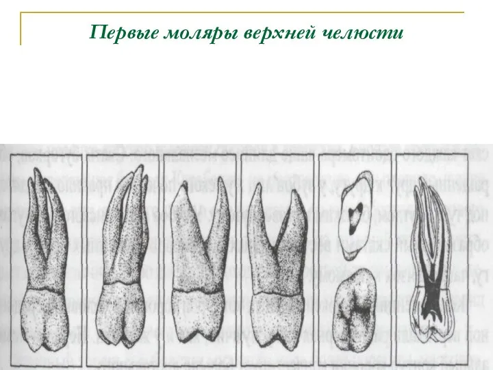 Первые моляры верхней челюсти