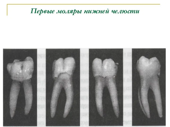 Первые моляры нижней челюсти