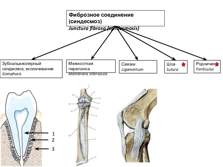 Фиброзное соединение (синдесмоз) Junctura fibrosa (syndesmosis) Зубоальвеолярный синдесмоз; вколачивание Gomphosis