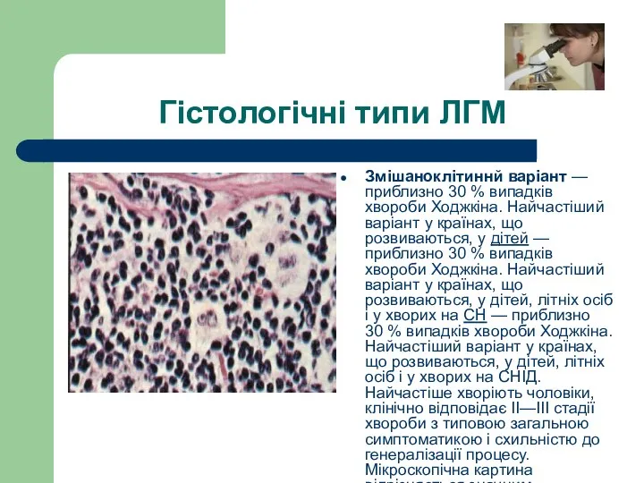 Гістологічні типи ЛГМ Змішаноклітиннй варіант — приблизно 30 % випадків