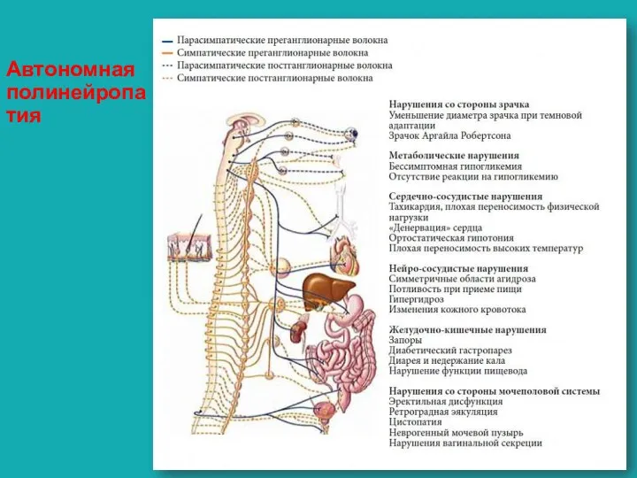 Автономная полинейропатия