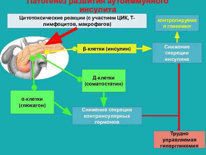 Патогенез развития аутоиммунного инсулита Цитотоксические реакции (с участием ЦИК, Т-лимфоцитов,