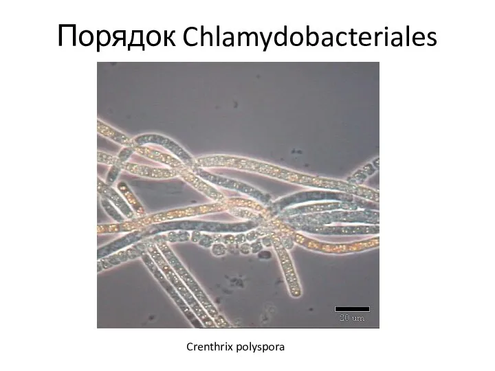 Порядок Chlamydobacteriales Crenthrix polyspora