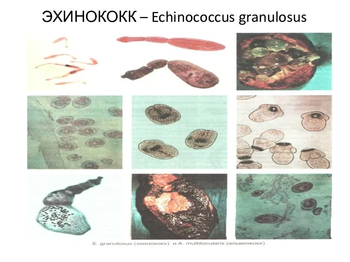 ЭХИНОКОКК – Echinococcus granulosus