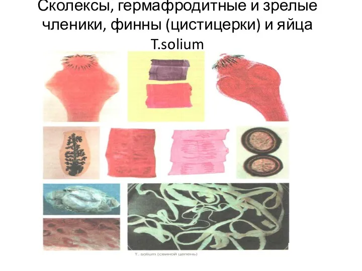 Сколексы, гермафродитные и зрелые членики, финны (цистицерки) и яйца T.solium