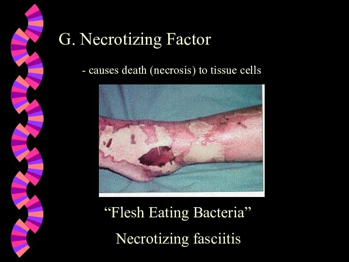 G. Necrotizing Factor - causes death (necrosis) to tissue cells “Flesh Eating Bacteria” Necrotizing fasciitis