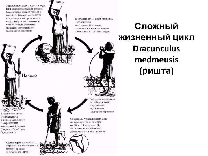 Сложный жизненный цикл Dracunculus medmeusis (ришта)