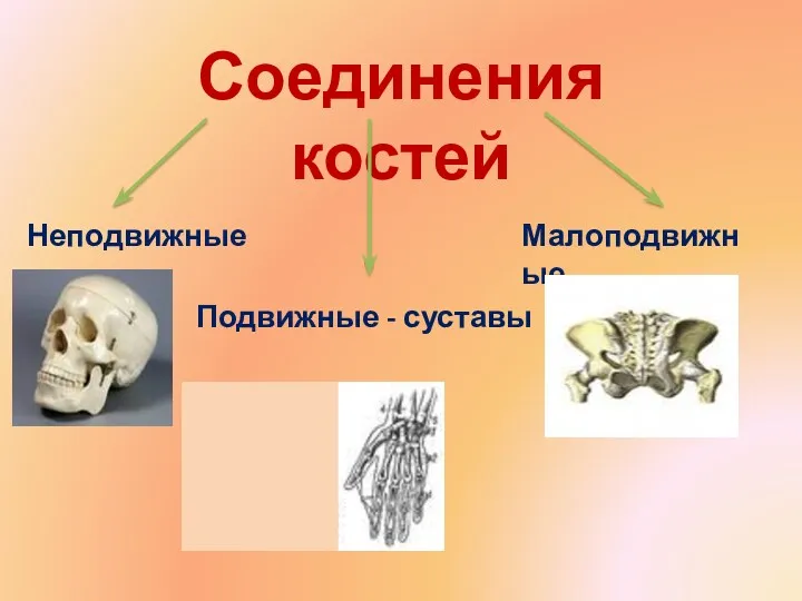 Соединения костей Неподвижные Подвижные - суставы Малоподвижные