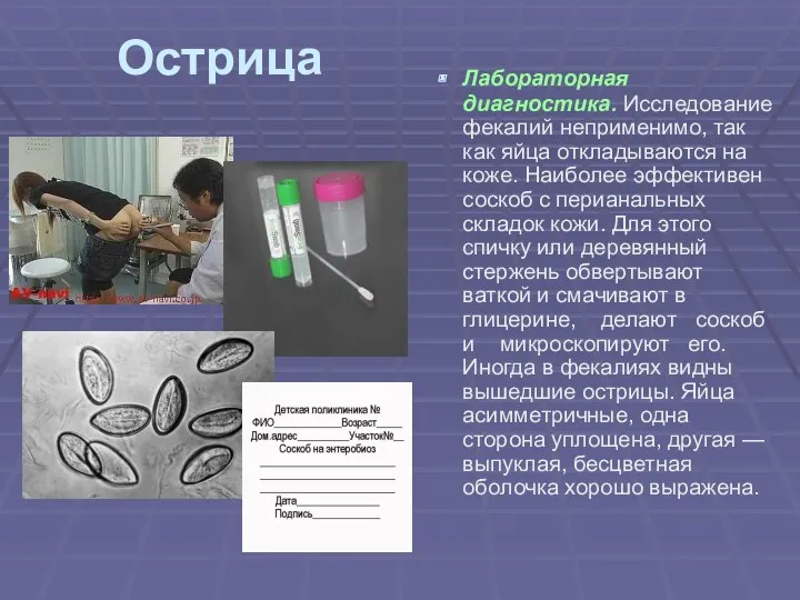 Острица Лабораторная диагностика. Исследование фекалий неприменимо, так как яйца откладываются