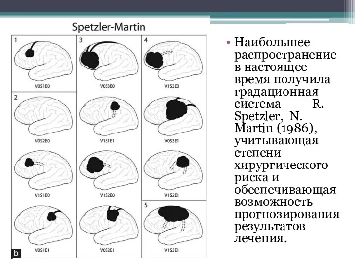 Наибольшее распространение в настоящее время получила градационная система R. Spetzler, N. Martin (1986),