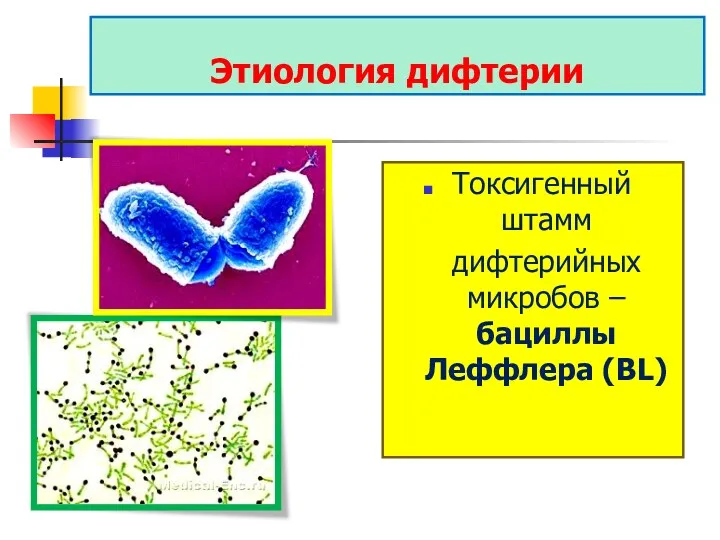 Этиология дифтерии Токсигенный штамм дифтерийных микробов – бациллы Леффлера (BL)