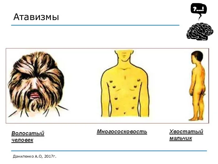 Атавизмы Даниленко А.О, 2017г.