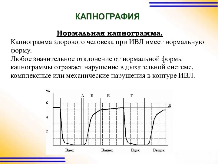 КАПНОГРАФИЯ Нормальная капнограмма. Капнограмма здорового человека при ИВЛ имеет нормальную форму. Любое значительное