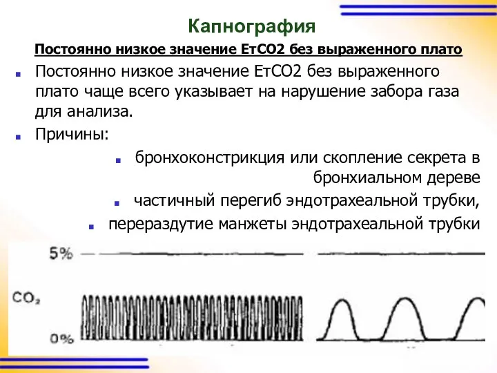 Капнография Постоянно низкое значение ЕтСО2 без выраженного плато Постоянно низкое