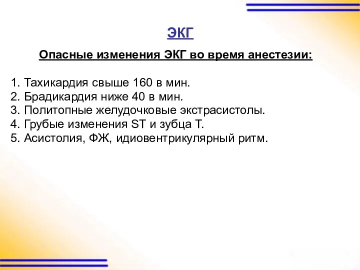 ЭКГ Опасные изменения ЭКГ во время анестезии: 1. Тахикардия свыше 160 в мин.