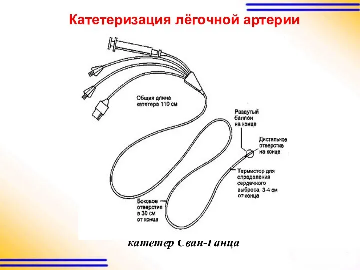 Катетеризация лёгочной артерии катетер Сван-Ганца