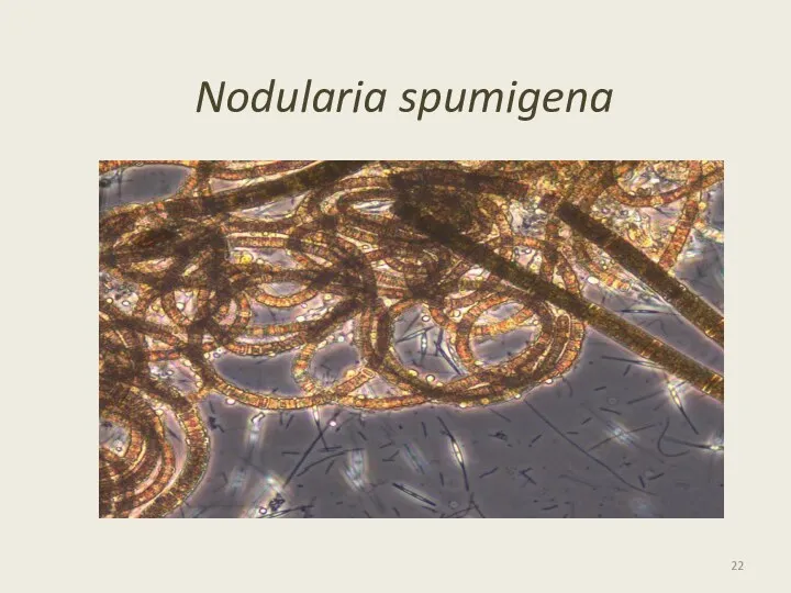 Nodularia spumigena
