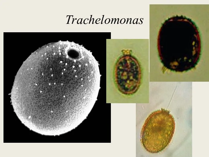 Trachelomonas