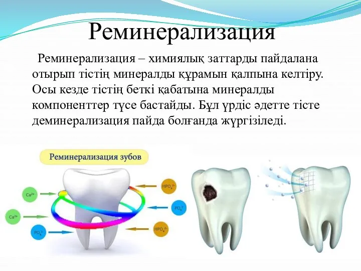 Реминерализация Реминерализация – химиялық заттарды пайдалана отырып тістің минералды құрамын