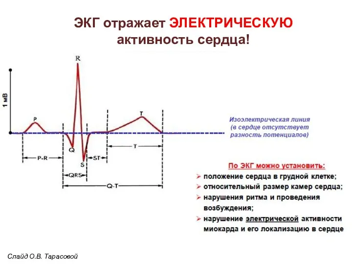 ЭКГ отражает ЭЛЕКТРИЧЕСКУЮ активность сердца! Слайд О.В. Тарасовой