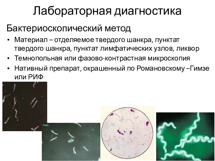 Лабораторная диагностика Бактериоскопический метод Материал – отделяемое твердого шанкра, пунктат