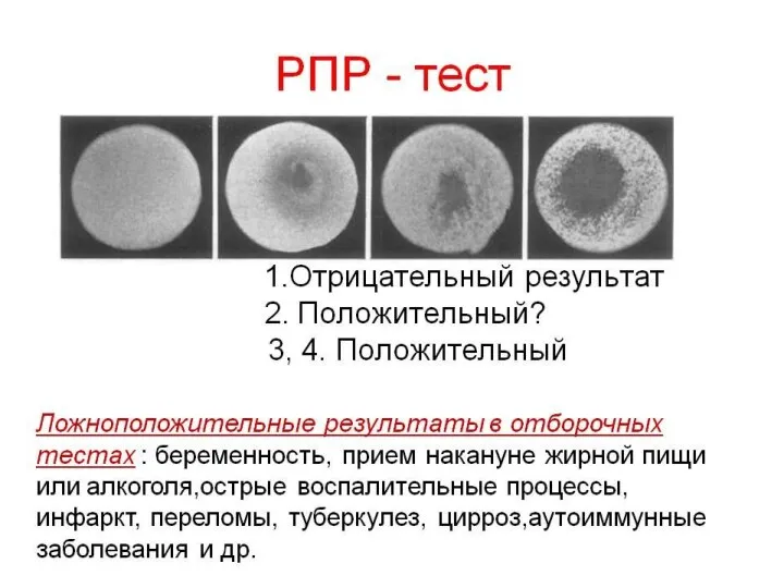 Лабораторная диагностика