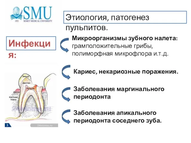 Этиология, патогенез пульпитов. Микроорганизмы зубного налета: грамположительные грибы, полиморфная микрофлора