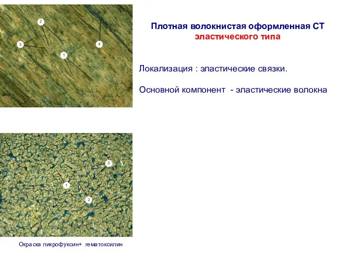 Плотная волокнистая оформленная СТ эластического типа Локализация : эластические связки.