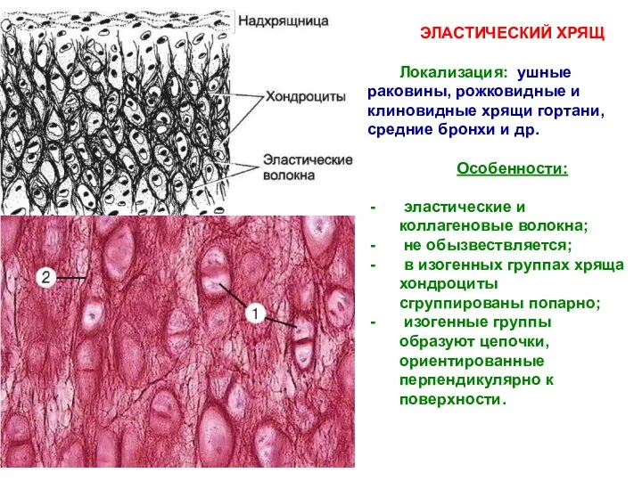 ЭЛАСТИЧЕСКИЙ ХРЯЩ Локализация: ушные раковины, рожковидные и клиновидные хрящи гортани,