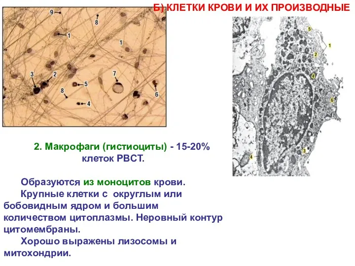 2. Макрофаги (гистиоциты) - 15-20% клеток РВСТ. Образуются из моноцитов