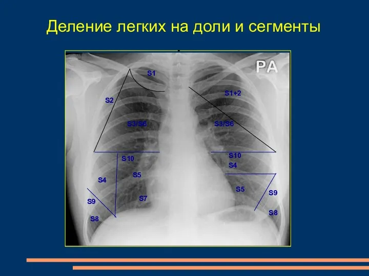 S5 S5 S3/S6 S4 S8 S8 Деление легких на доли