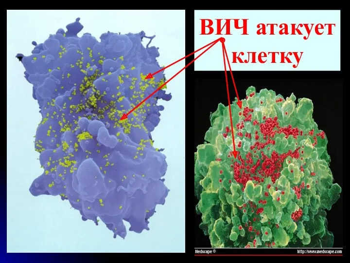 ВИЧ атакует клетку