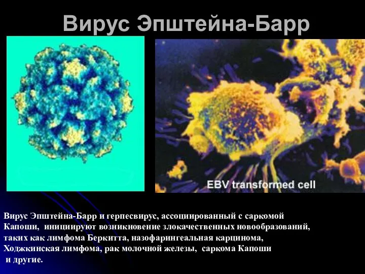 Вирус Эпштейна-Барр Вирус Эпштейна-Барр и герпесвирус, ассоциированный с саркомой Капоши, инициируют возникновение злокачественных