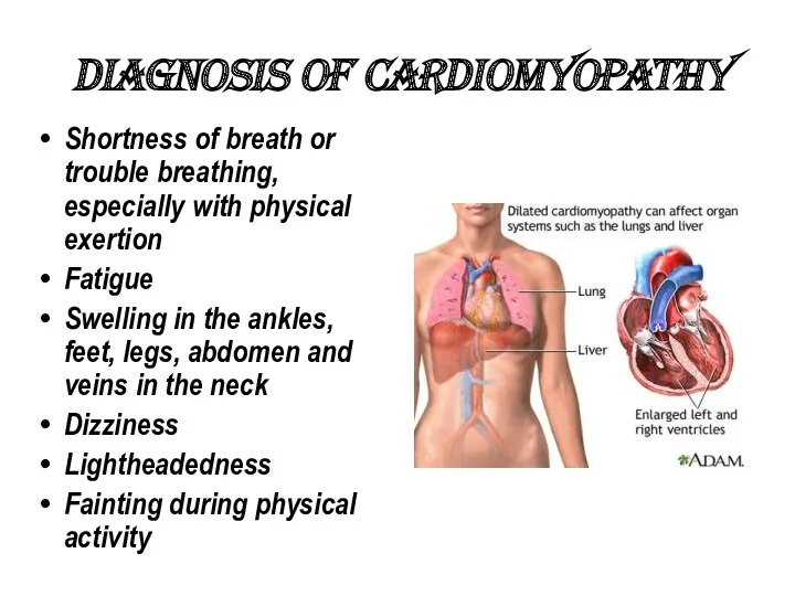 Diagnosis of Cardiomyopathy Shortness of breath or trouble breathing, especially